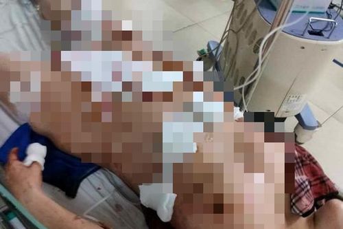 Bắt giữ khẩn cấp gã chồng chích điện và dùng dao tấn công vợ