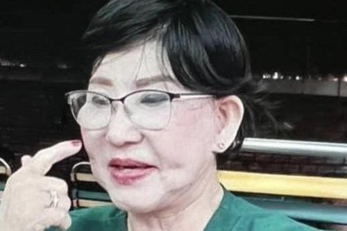 Truy tìm nghi phạm 'dụ dỗ' quý bà tiêm filler ở nhà nghỉ rồi chiếm đoạt tài sản