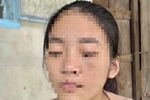 Thiếu nữ 16 tuổi bị chủ hành hạ khi đi làm để trả nợ cho bà: Hành vi gây phẫn nộ xã hội