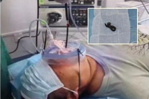 Ho nửa tháng không đỡ, phát hiện 'quái vật' hút máu trong họng