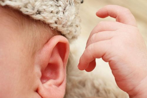 Câm điếc bẩm sinh