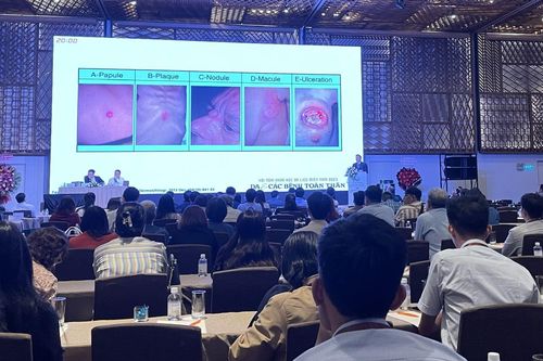 Tỷ lệ mắc bệnh tâm thần ngày càng tăng ở các bệnh nhân khám da liễu