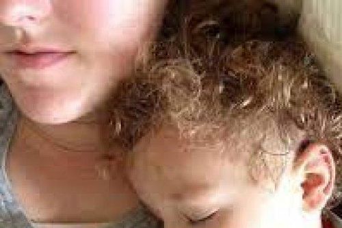 Bức ảnh cậu bé đang ngủ cho thấy dấu hiệu của 1 loại bệnh nghiêm trọng