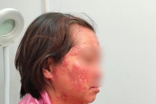 Nỗi đau của người phụ nữ mắc căn bệnh nhiều người không dám đến gần