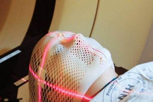 80 năm sống với một vật nguy hiểm trong não, nguyên nhân vật đó 'chui vào' não còn gây sốc hơn