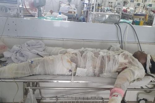 Năm người thương vong từ vụ chủ nhà dùng xăng đốt phòng ngủ
