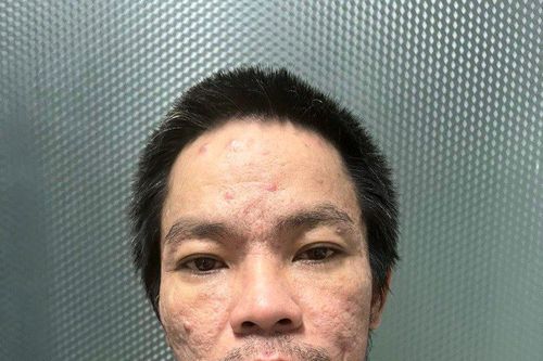Giang hồ cộm cán Hải 'mặt rỗ' bị tóm ở Đà Nẵng
