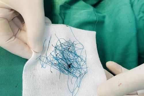 Hiểm họa từ trào lưu 'nâng mũi chỉ' quảng cáo trên mạng