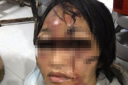 Bắt đối tượng đánh đập dã man người tình cùng con gái