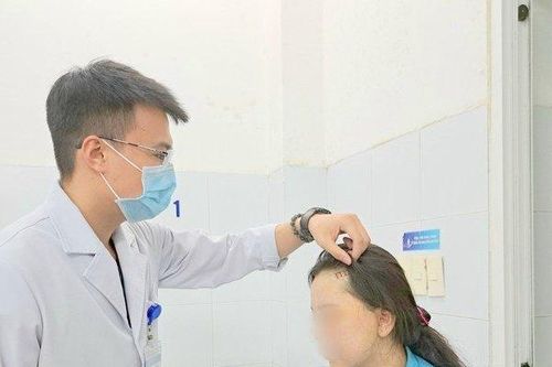 Phẫu thuật giúp thiếu nữ 19 tuổi thoát bệnh động kinh