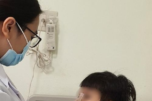 Bé trai gãy xương mũi, vì xem bạn chơi trò mà giới trẻ 'say mê'