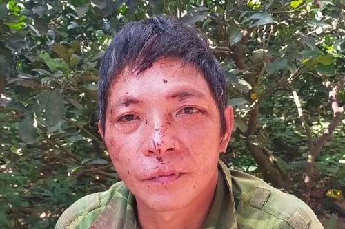 Chồng đánh vợ tử vong vì bị ngăn dùng điện thoại