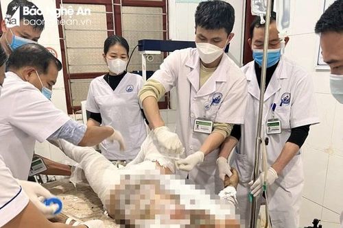 Chồng đổ xăng lên người rồi tự thiêu trước mặt vợ