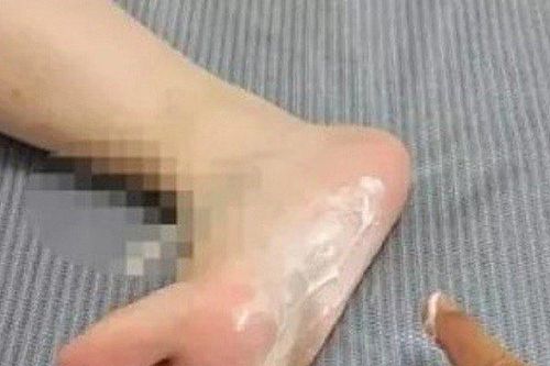 Bôi kem đánh răng vào lòng bàn chân: Lợi ích tuyệt vời ít người biết