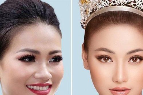 Ngắm nhan sắc hiện tại của các Hoa hậu, Á hậu biết ngay chất lượng Bệnh viện thẩm mỹ Việt Mỹ 'xịn sò' cỡ nào