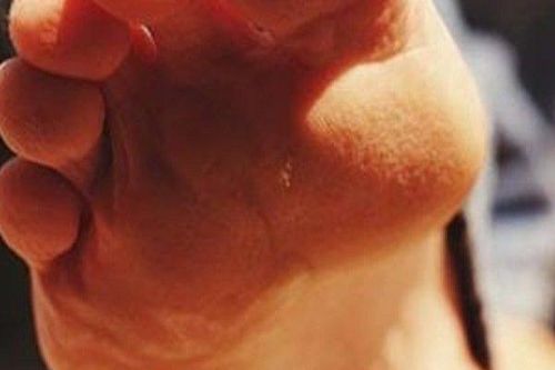 Người đàn ông nguy kịch, thở máy vì giẫm phải vật này ở nhà