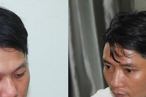 Bắt 2 thanh niên giả làm khách mua điện thoại để cướp giật