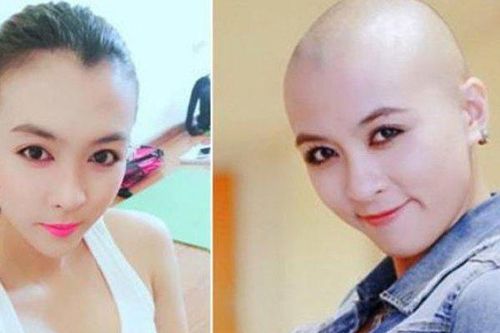Mỹ nhân showbiz bất ngờ xuống tóc: Người bị trầm cảm nặng, kẻ muốn báo hiếu bố mẹ