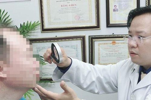 Nguy cơ mù mắt do điều trị zona thần kinh bằng đậu xanh giã nát
