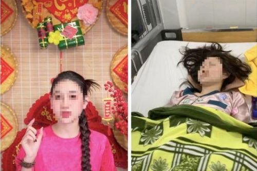 Ngủ dậy, nữ TikToker bất ngờ mất thị lực, liệt giường, bác sĩ chỉ rõ nguyên nhân gây bệnh chính từ... một cơn ho