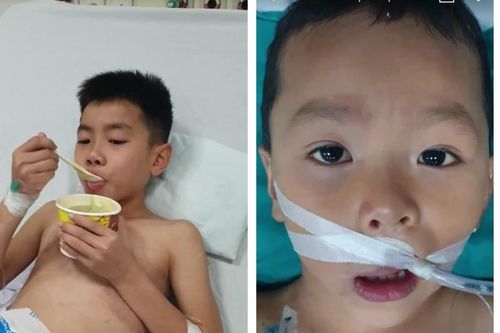 Vụ hai cháu bé ở Thanh Hóa hôn mê sau ăn bim bim lạ: Hồi tỉnh thần kỳ