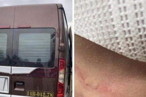 Nữ hành khách kể lại phút bị nhà xe hành hung, bỏ rơi giữa cao tốc