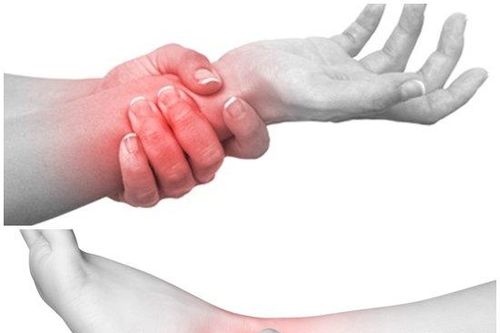 Viêm bao hoạt dịch các khớp