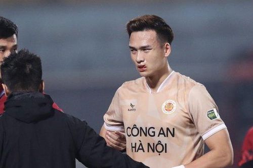 Bùi Hoàng Việt Anh cập nhật tình trạng chấn thương, bỏ ngỏ khả năng góp mặt trận gặp Indonesia