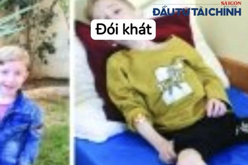 Liên Hợp Quốc cáo buộc Israel sử dụng nạn đói làm 'vũ khí chiến tranh'