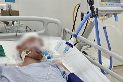 Nam sinh lớp 8 bị đánh chấn thương sọ não: Trách nhiệm người bố?