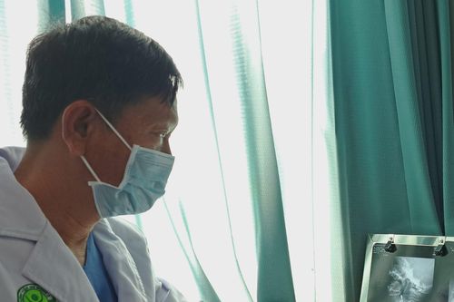 Lấy chiếc kim băng trong thực quản bé trai 10 tháng tuổi