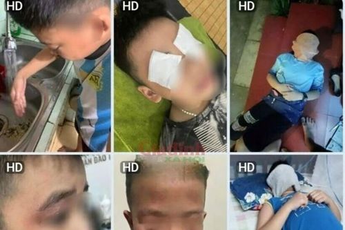 Hàng loạt học sinh Hà Nội bị dị ứng thuốc diệt muỗi: Chuyên gia nói gì?