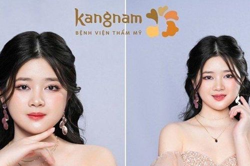 Cộng đồng mạng 'vỡ òa' với màn lột xác ngoạn mục của cô gái mặt lõm