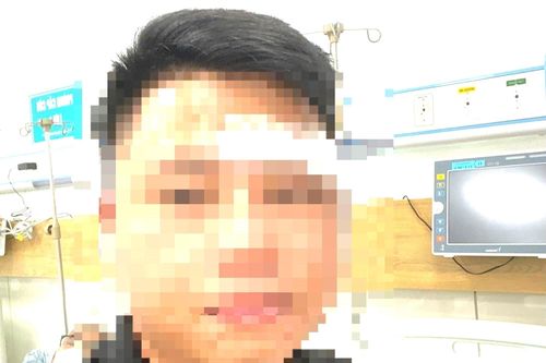 Bị nhóm người lạ hành hung, một luật sư ở Đà Nẵng phải nhập viện cấp cứu