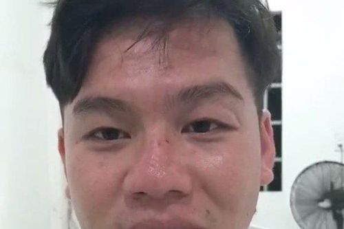 Tây Ninh: Phá thành công một vụ cướp giật tài sản