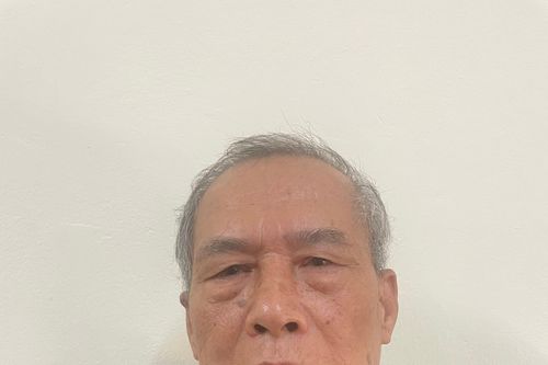 Truy tìm đối tượng trong vụ án Cố ý gây thương tích