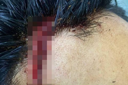 Đắk Nông: Nhóm đối tượng vào chốt tấn công lực lượng bảo vệ rừng