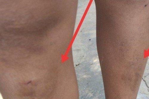 Tin tức 24h qua: 5 cháu nhỏ bị hàng xóm đánh bầm dập, bắt quỳ giữa đường