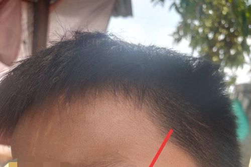 Làm rõ vụ hai mẹ con đánh 5 cháu nhỏ bị thương