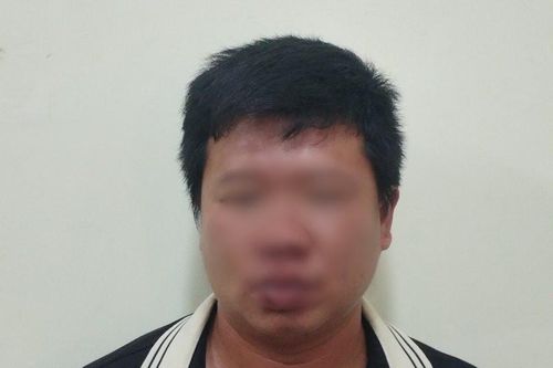 Tấn công 5 phụ nữ đi đường, 1 người tử vong