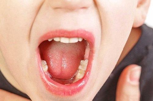 Bản tin 12/5: Đề phòng nguy cơ dịch tay chân miệng bùng phát