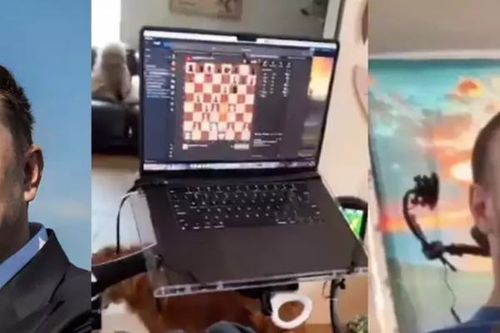 Elon Musk tìm ứng viên thứ 2 cấy chip não Neuralink, ai đủ điều kiện?