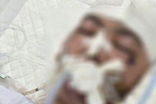 Nam sinh lớp 8 bị đánh chấn thương sọ não chuyển về Hà Nội điều trị