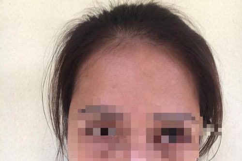 Chị bán gà bị lừa 10 triệu tình huống ít ai ngờ