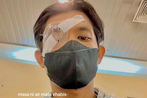 Chàng trai Malaysia phải ghép giác mạc vì thói quen dụi mắt quá nhiều