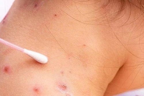 Tin tức Đời sống 27/5: Nguy kịch vì căn bệnh quen thuộc