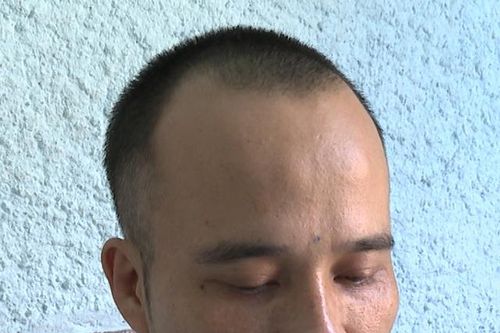 Đối tượng có 4 tiền án vẫn liên tiếp gây ra hàng loạt các vụ trộm cắp trong bệnh viện