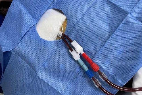 Đề xuất sửa điều kiện thanh toán dịch vụ kỹ thuật y tế thuộc phạm vi được hưởng bảo hiểm y tế