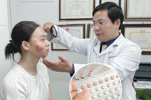 Rước họa vào thân sau khi uống thuốc tránh thai khẩn cấp để trị mụn