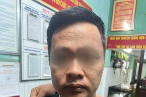 TP.HCM: Truy xét, bắt nhanh các đối tượng cướp giật tài sản